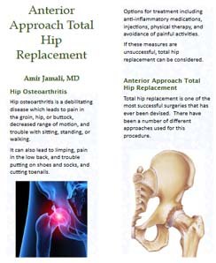 anterior approach total hip replacement in Pdf format
