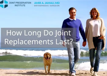 How Long Do Joint Replacements Last?