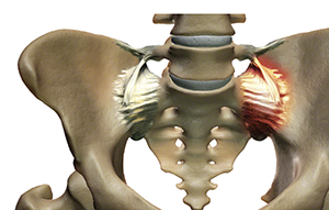 Pelvis si pain