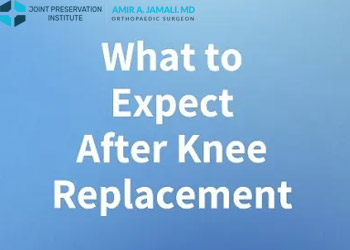 What to Expect after Knee Replacement